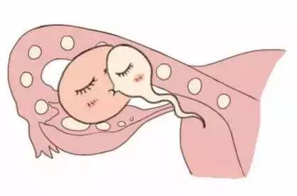 供卵代怀生男宝代生包成功